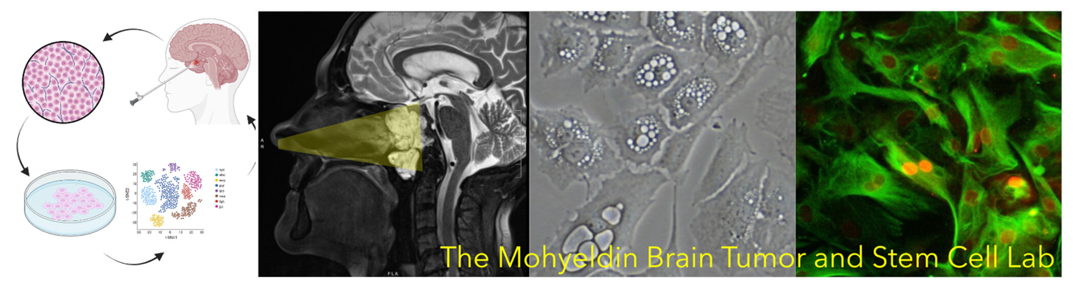 The Mohyeldin brain tumor research lab